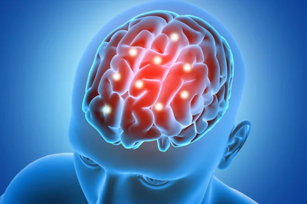 Pituitary Adenoma