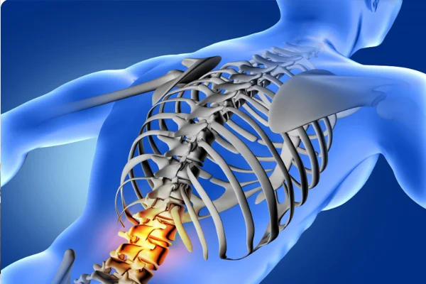 Spinal Tumors